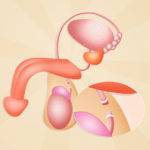 Vazektomia - mužská serilizácia