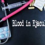 Krv v ejakuláte